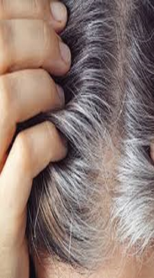 reasons of white Hair Problem